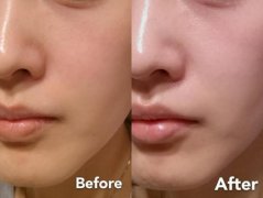 ������Ʒ����|͸��������+��ԭ�����䷽����-Դͷ����ֱ�����з�